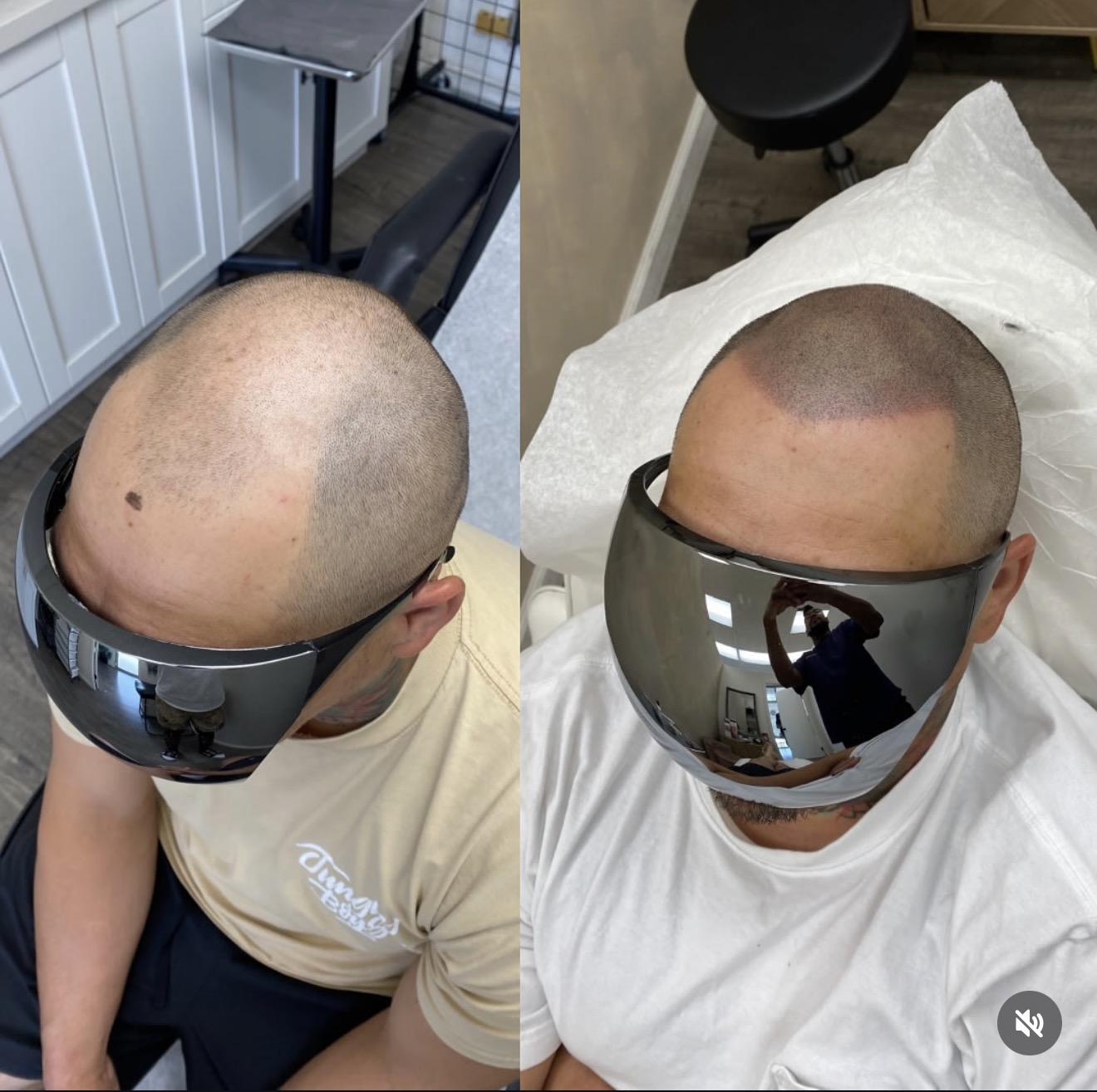 SMP Before and After Supreme SMP Hawaii